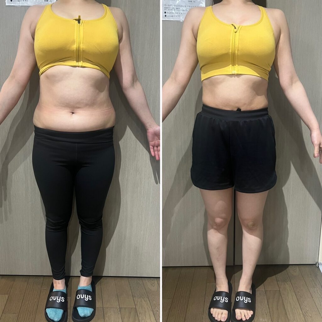 ビフォーアフター