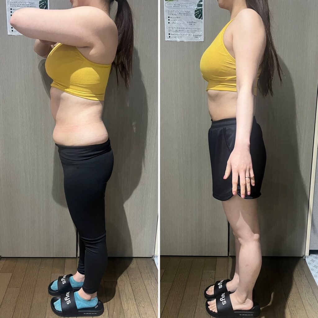 ビフォーアフター